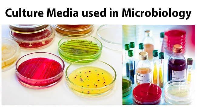 Microbiology Culture Media Chart